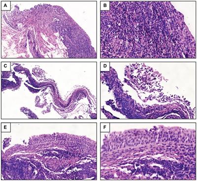 Frontiers Comparative Genomic Analysis Of Uropathogenic Escherichia   1340427 Thumb 400 